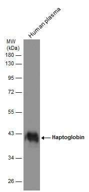 Haptoglobin Rabbit Polyclonal Antibody