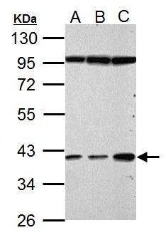 Haptoglobin Rabbit Polyclonal Antibody