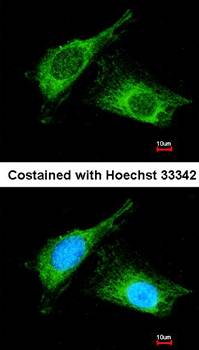 Haptoglobin antibody