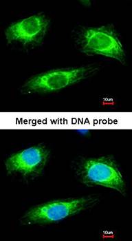 Haptoglobin antibody