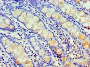HARS Antibody
