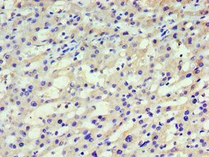 HARS Antibody