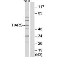 HARS antibody