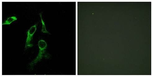 HARS Antibody