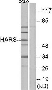 HARS Antibody