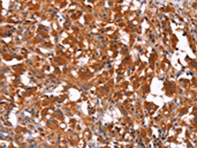 HAS1 Antibody