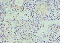 HAT1 Antibody