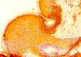 HAUS4 Antibody