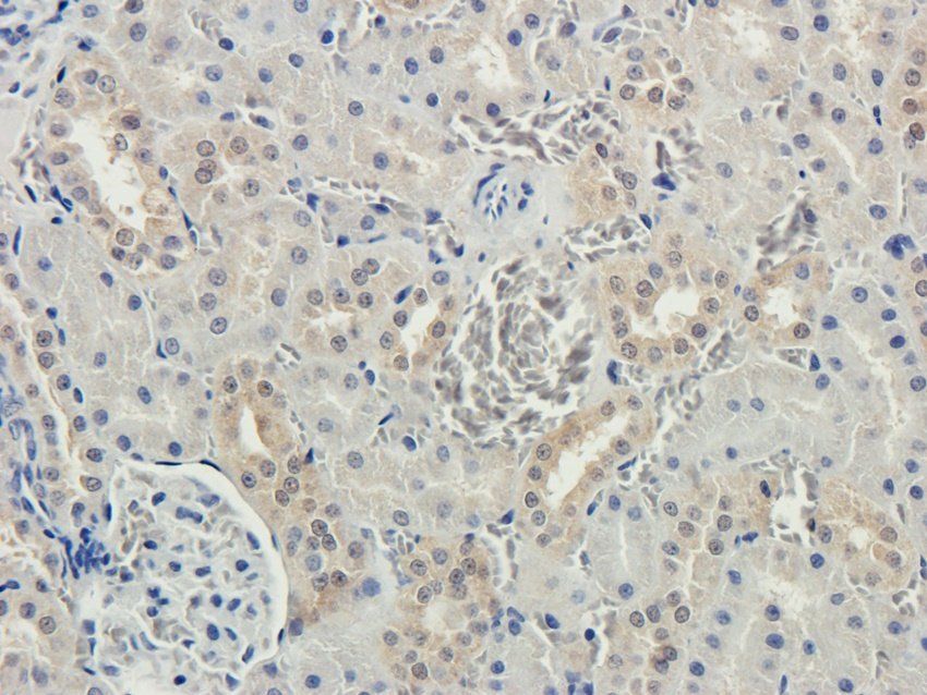 HAVCR2 antibody