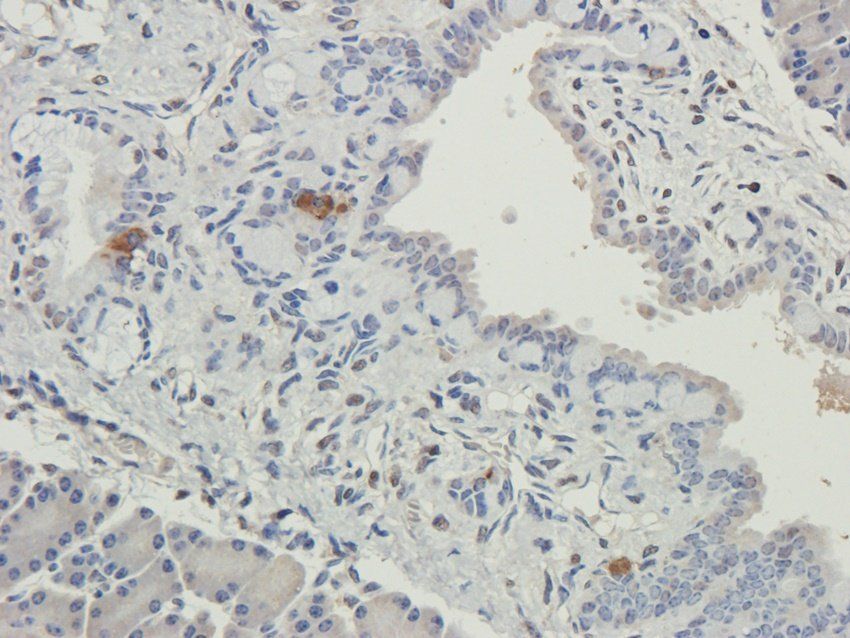 HAVCR2 antibody