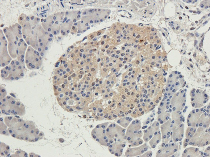 HAVCR2 antibody