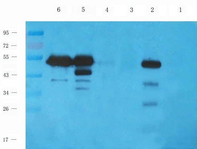 HAVCR2 antibody