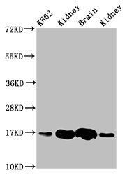 HBG2 antibody