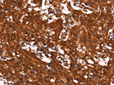 HCAR2 Antibody