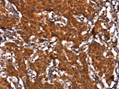 HCAR2 Antibody