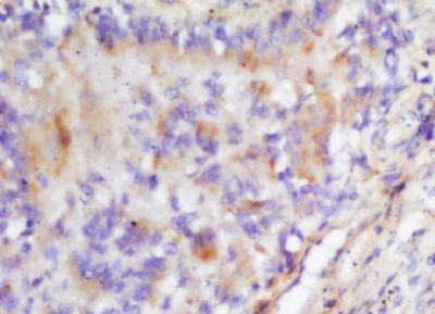 CCL14/SCYL2 Rabbit Polyclonal Antibody