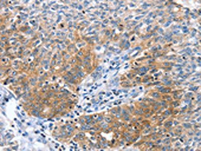 CGB Antibody