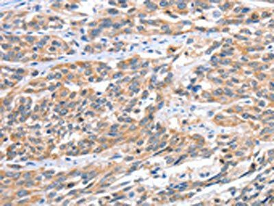 CGB Antibody