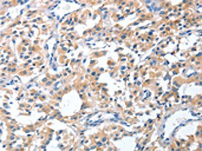 CGB Antibody