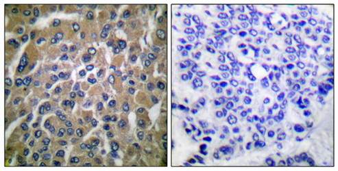 hCG β Antibody