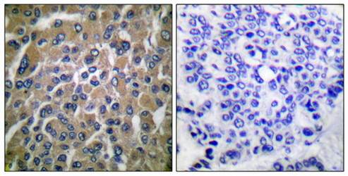 HCG antibody