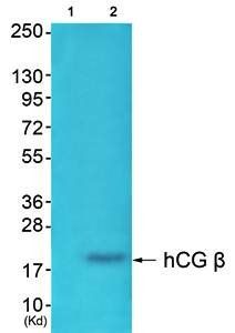 hCG β Antibody