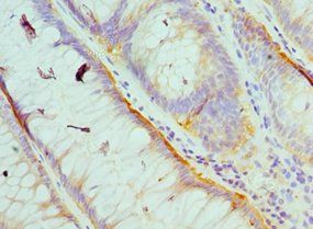 HCK Antibody
