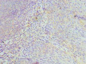 HCK Antibody