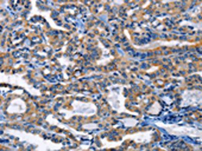 HCK Antibody