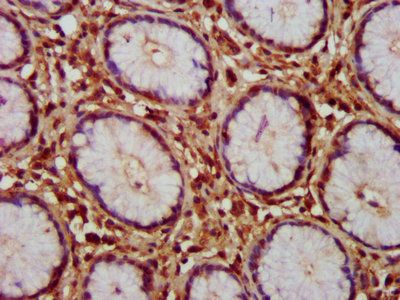 HAX1 Antibody