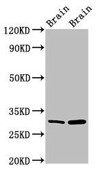 HCLS1-associated protein X-1 antibody