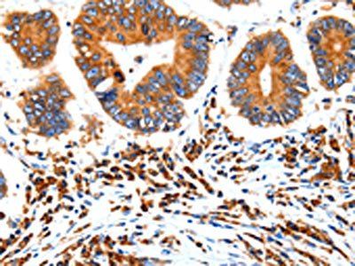 HCN1 Antibody