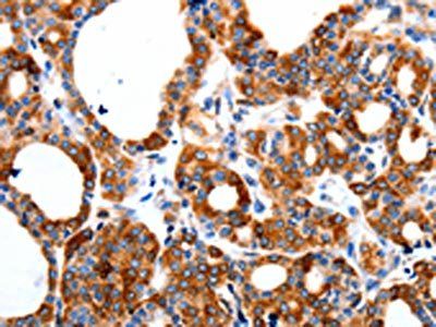 HCN1 Antibody