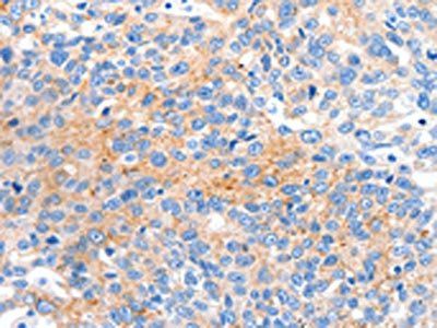 HCN2 Antibody