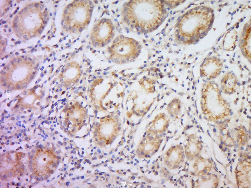 HCP5 Rabbit Polyclonal Antibody