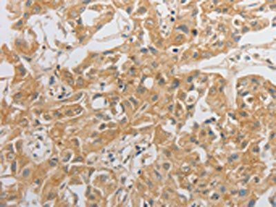 HCRTR2 Antibody