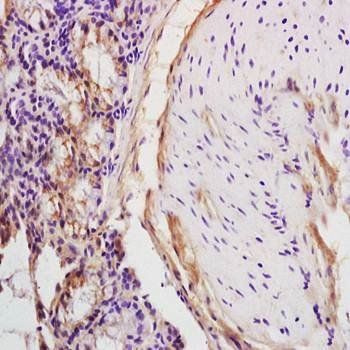 HCV NS3 Rabbit Polyclonal Antibody