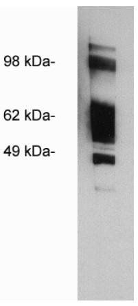 Rabbit Human HDAC1 Antibody