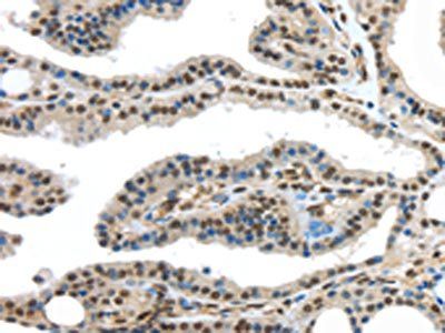 HDAC1 Antibody