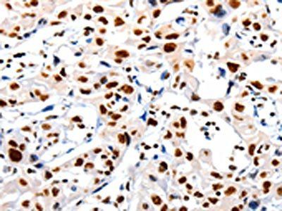HDAC1 Antibody
