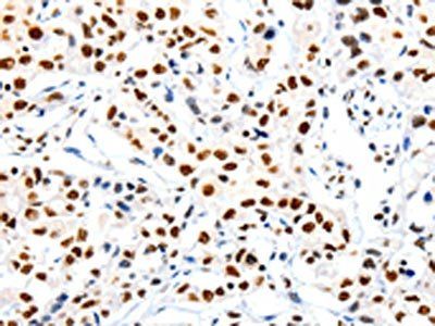 HDAC1 Antibody