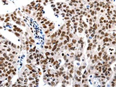 HDAC1 Antibody