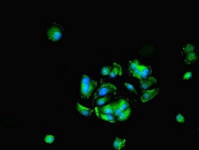 HDAC10 Antibody