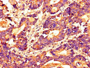 HDAC10 Antibody