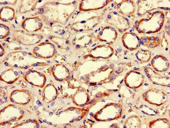HDAC10 Antibody