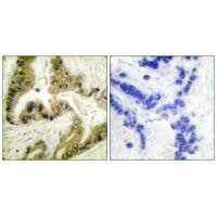 HDAC10 Antibody