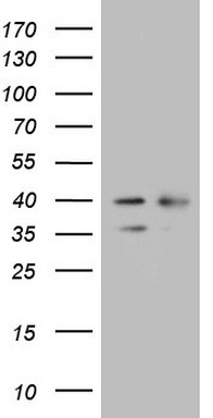 HDAC11 Antibody