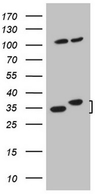 HDAC11 Antibody
