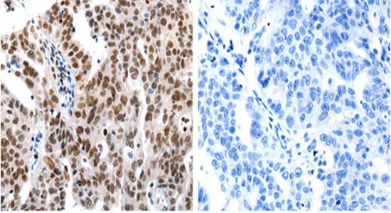 HDAC1 Antibody