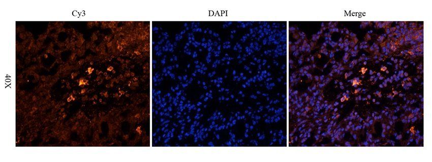 HDAC2 antibody